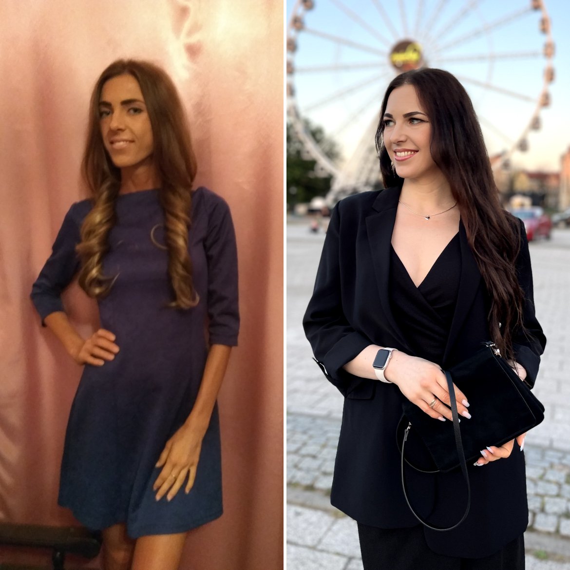 Фото до и после РПП