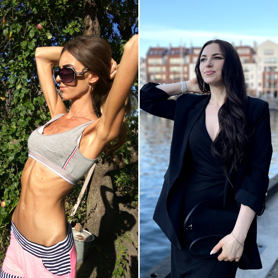 Фото до и после РПП